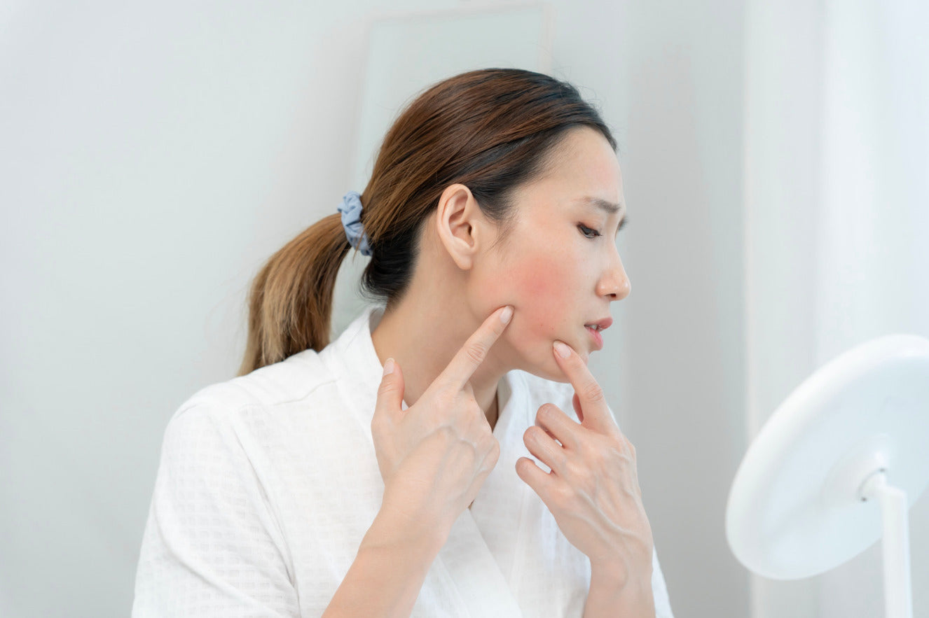 ¿Cómo empezar con skincare? Guía para prevenir irritacion 