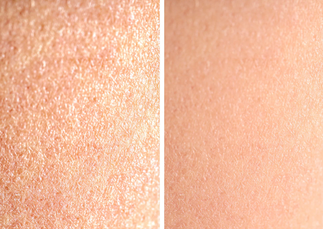 Comparacion visual de la piel seca vs. la piel hidratada. A la izquierda, piel seca con falta de brillo. A la derecha, piel hidratada. 
