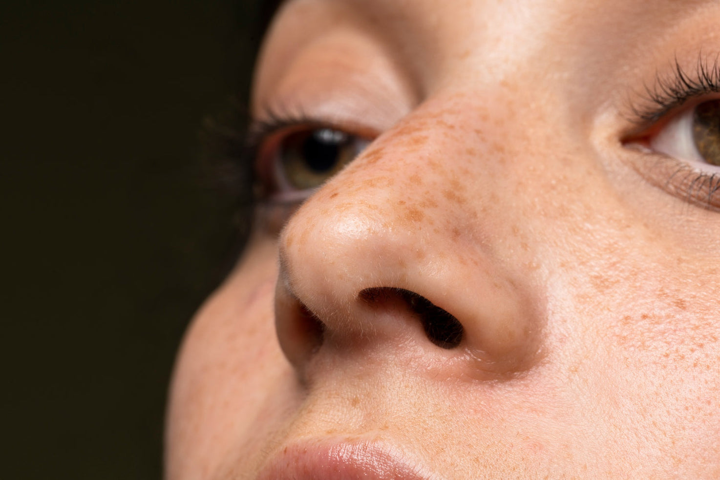 Close-up de la cara de una mujer de piel clara que presenta pecas. La imagen ilustra la melanogénesis y la pigmentación en la piel.