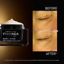 Global-Repair Advanced Eyes & Lips 15 ml